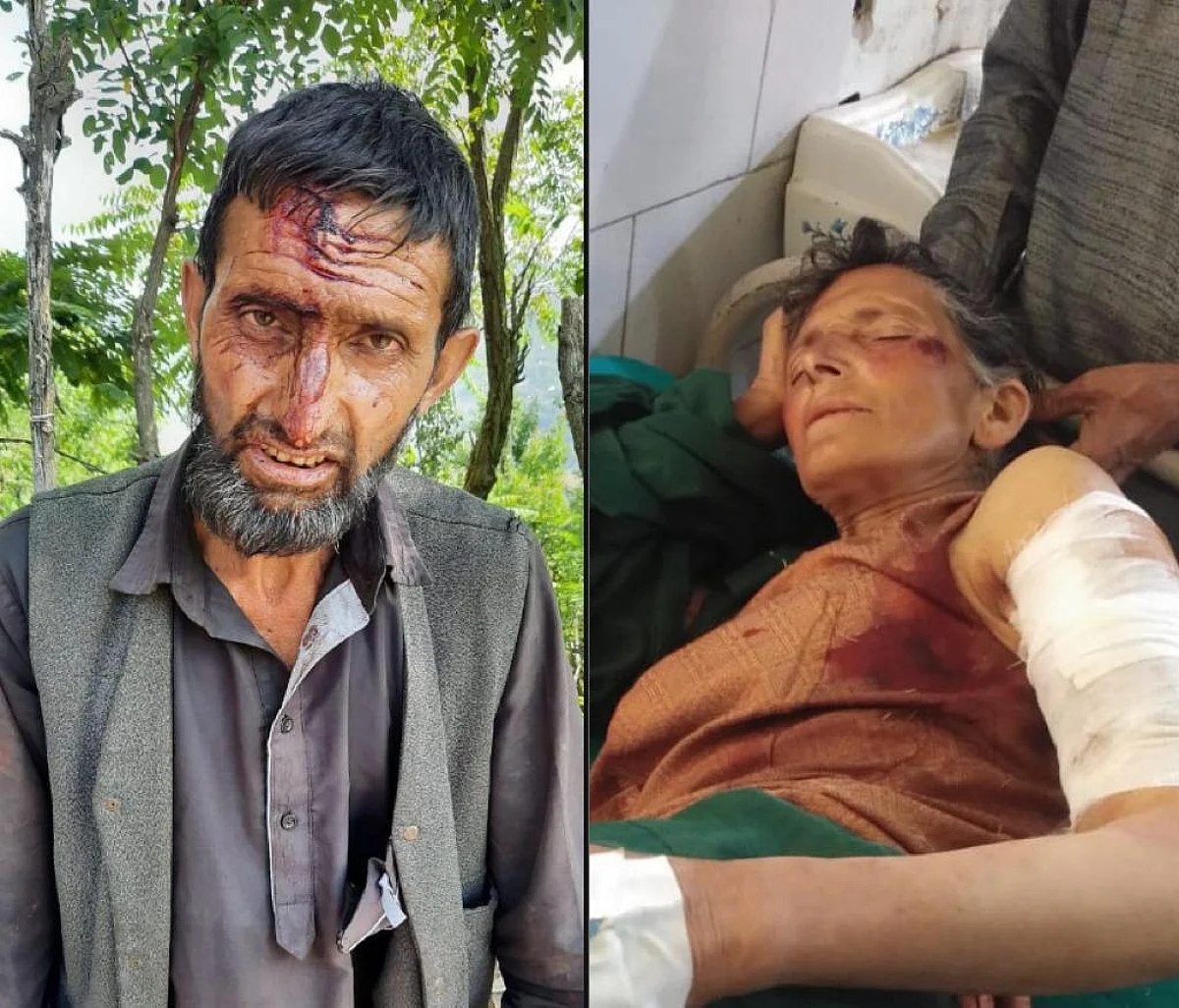 The two were injured in separate bear attacks in Banihal.
