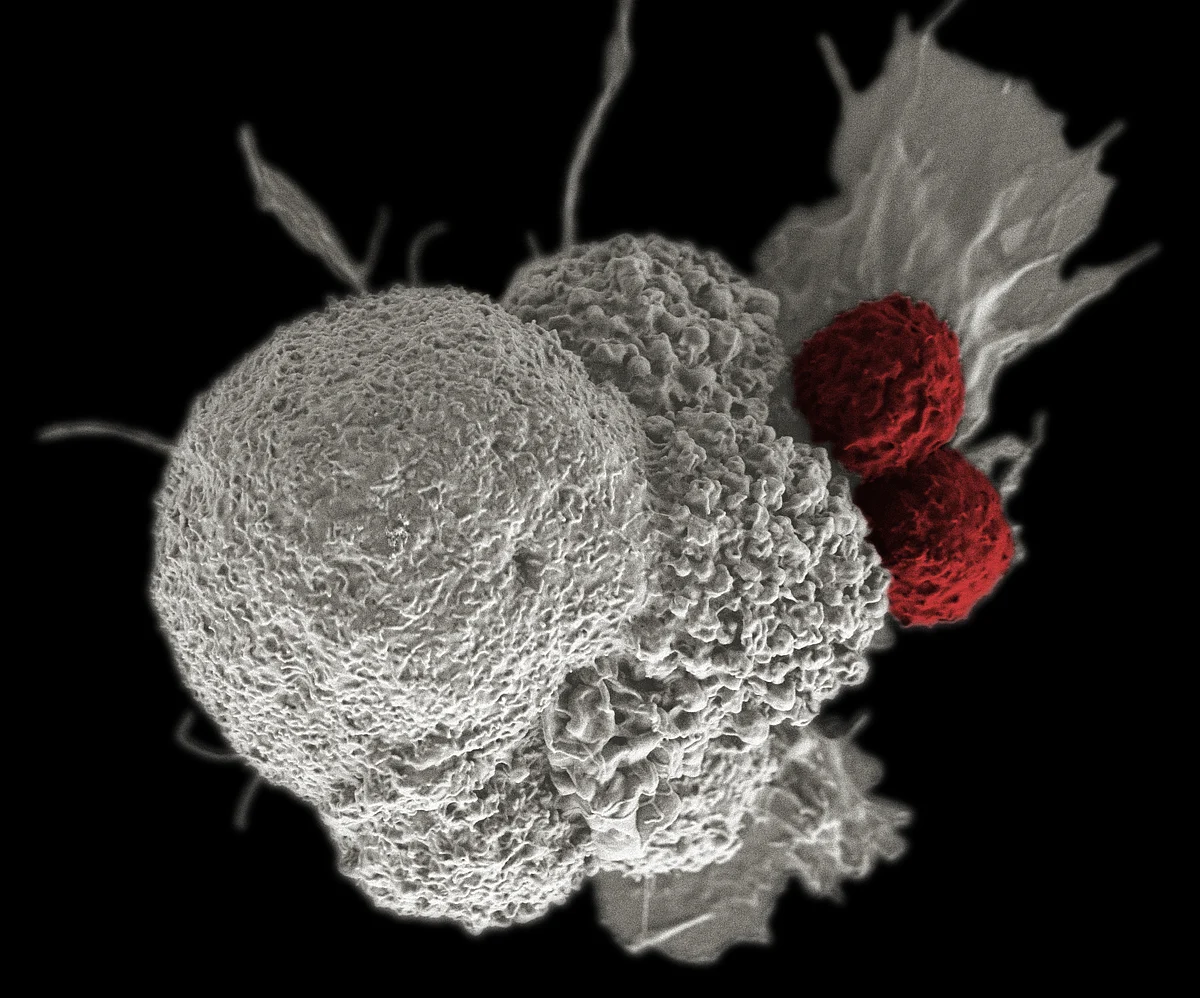 CME on Recent Advances in Oncology held