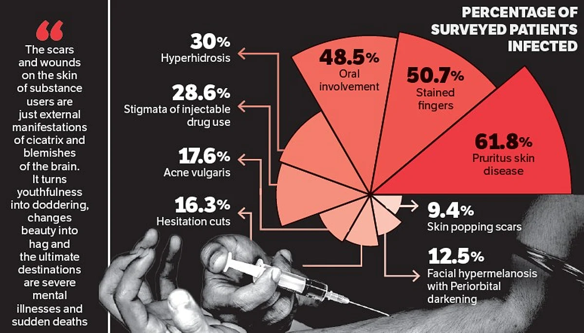 Percentage of surveyed patients