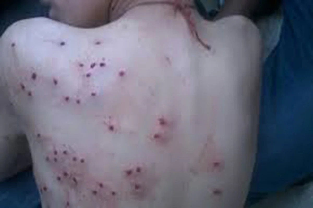 Pellet gun a lethal weapon: Hurriyat (G)