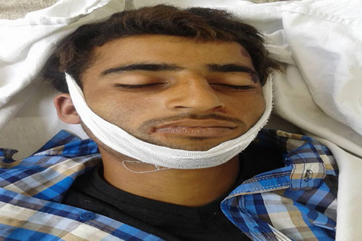 Speeding car crushes young boy to death at Ompora in central Kashmir
