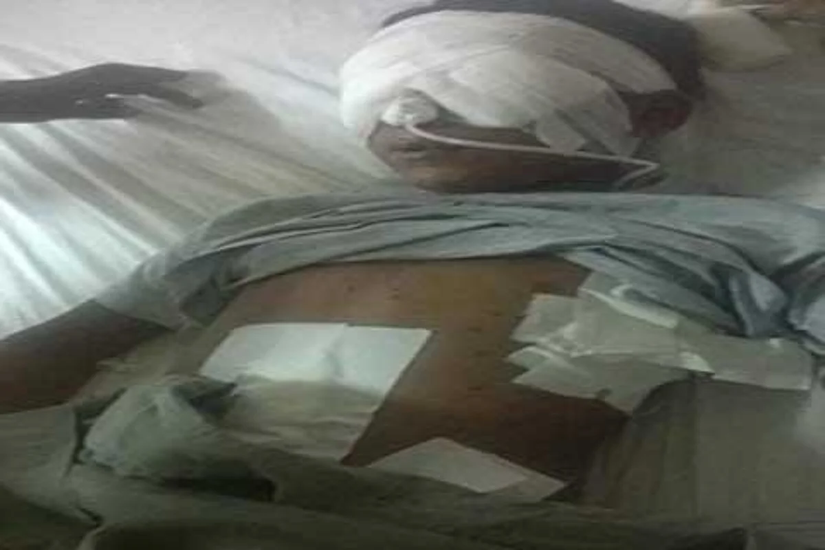 New Delhi rushes team of eye-specialists to JK