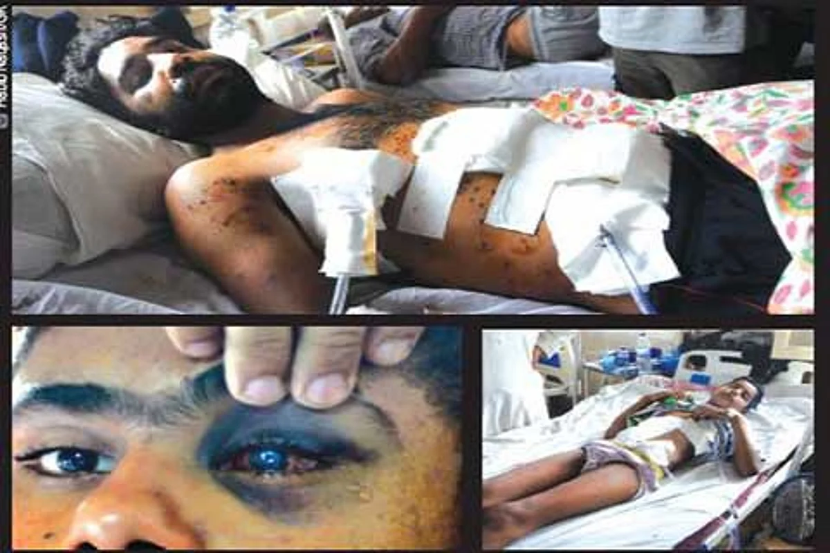 Non-lethal? At SMHS hospital, 2 deaths due to pellets in 5 days