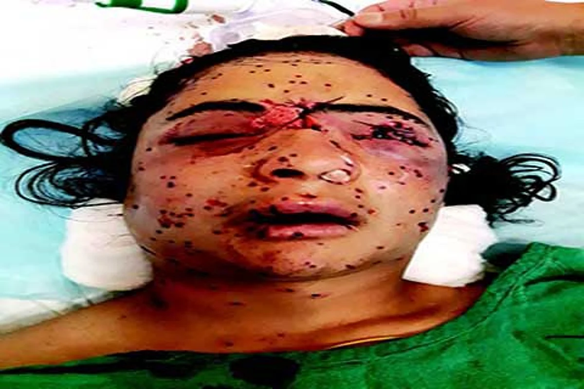 Pellet gun lethal, says HCBA