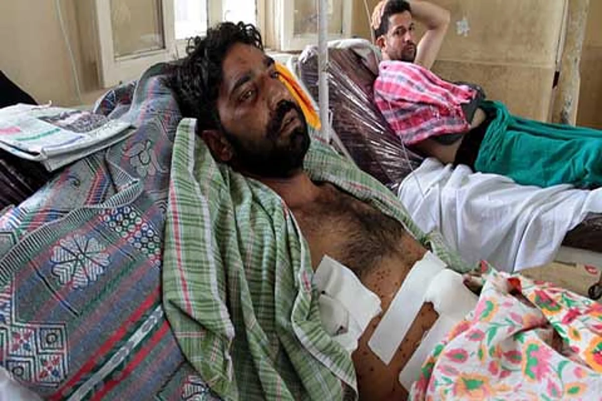‘War-like situation’, says AIIMS specialist on pellet injuries