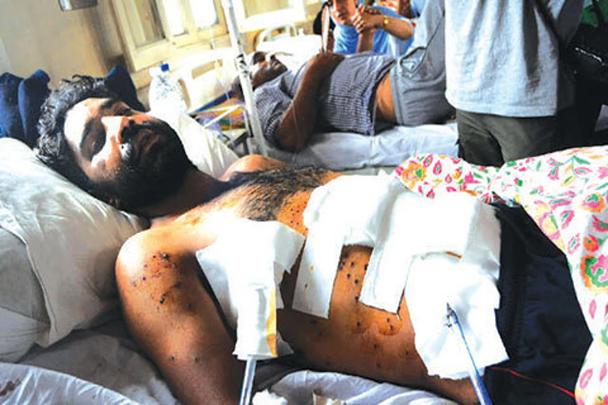“Govt to shift patients with serious injuries outside state”