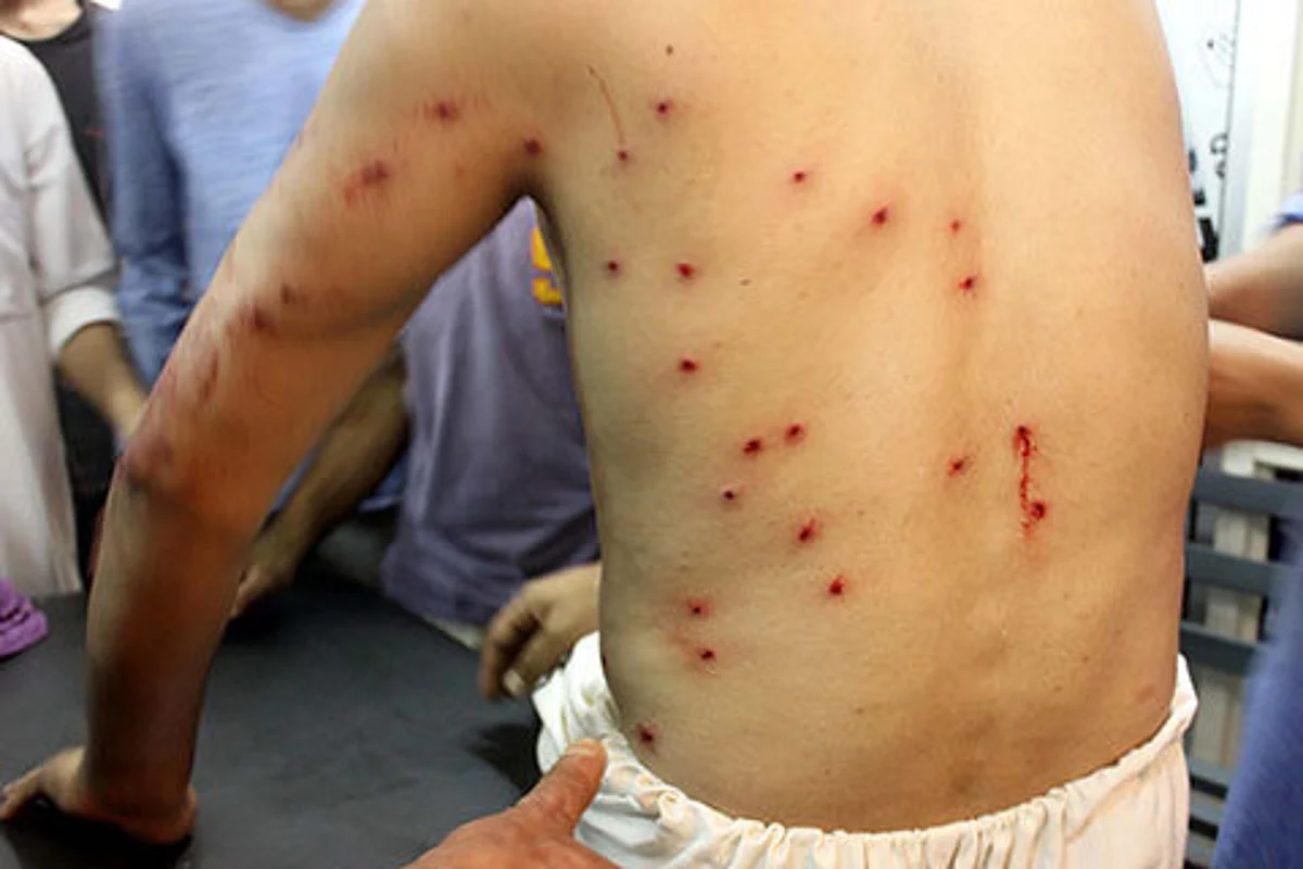 Pellet terror continues: 6, including girl, injured