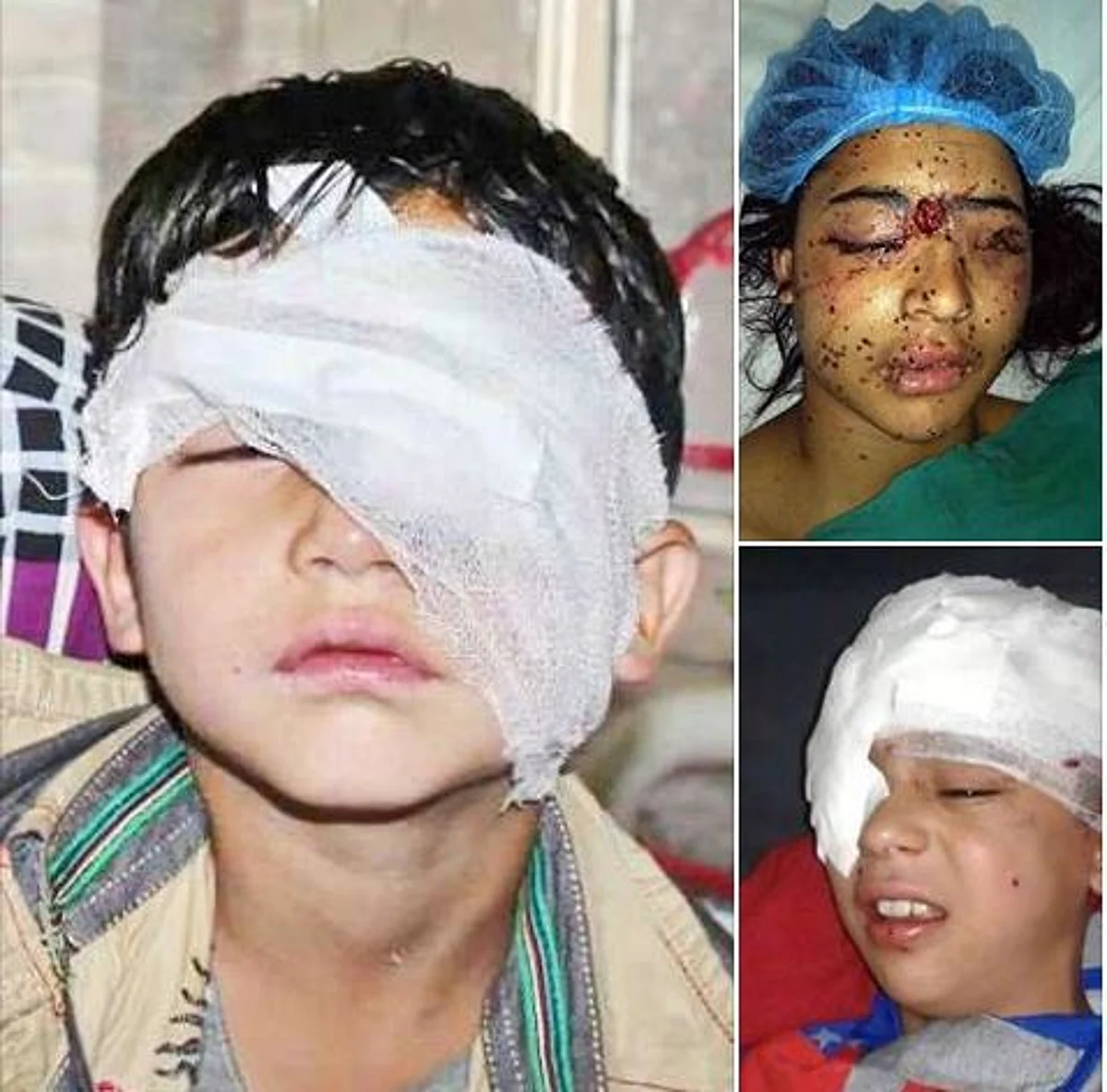 Review use of pellet guns, High Court tells Govt