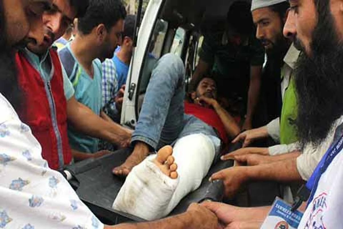Hit by pellets, Ishfaq may limp for life