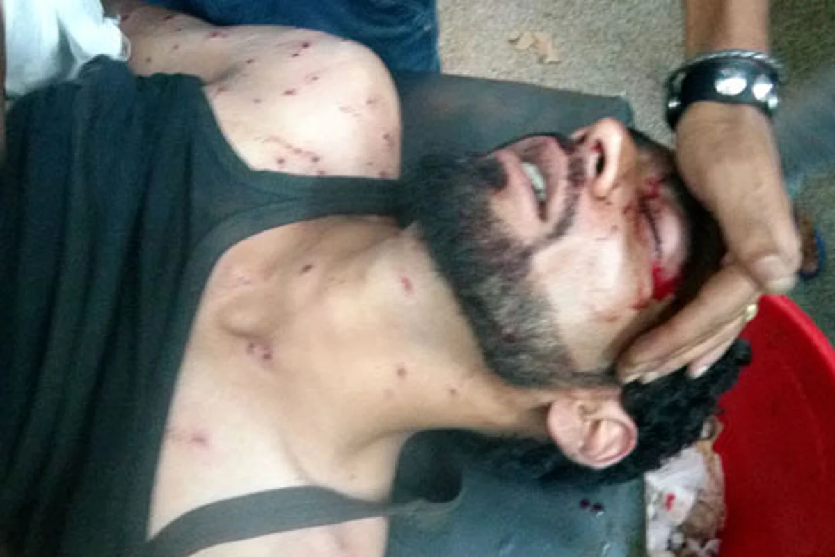 Engineering student among two hit by pellets in Anantnag