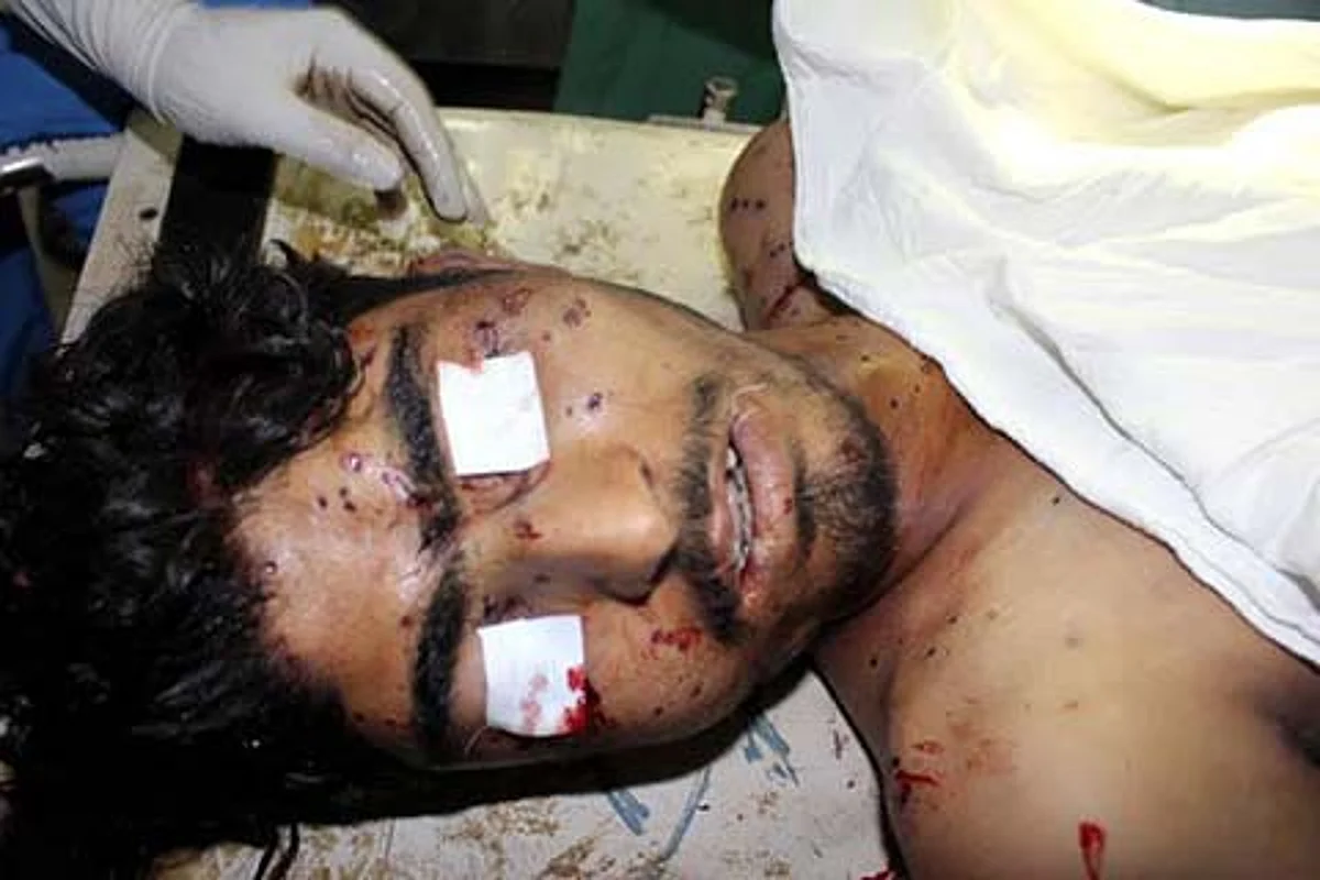 ‘Non-Lethal’ Pellets Kill At-Least 6 in 50 days