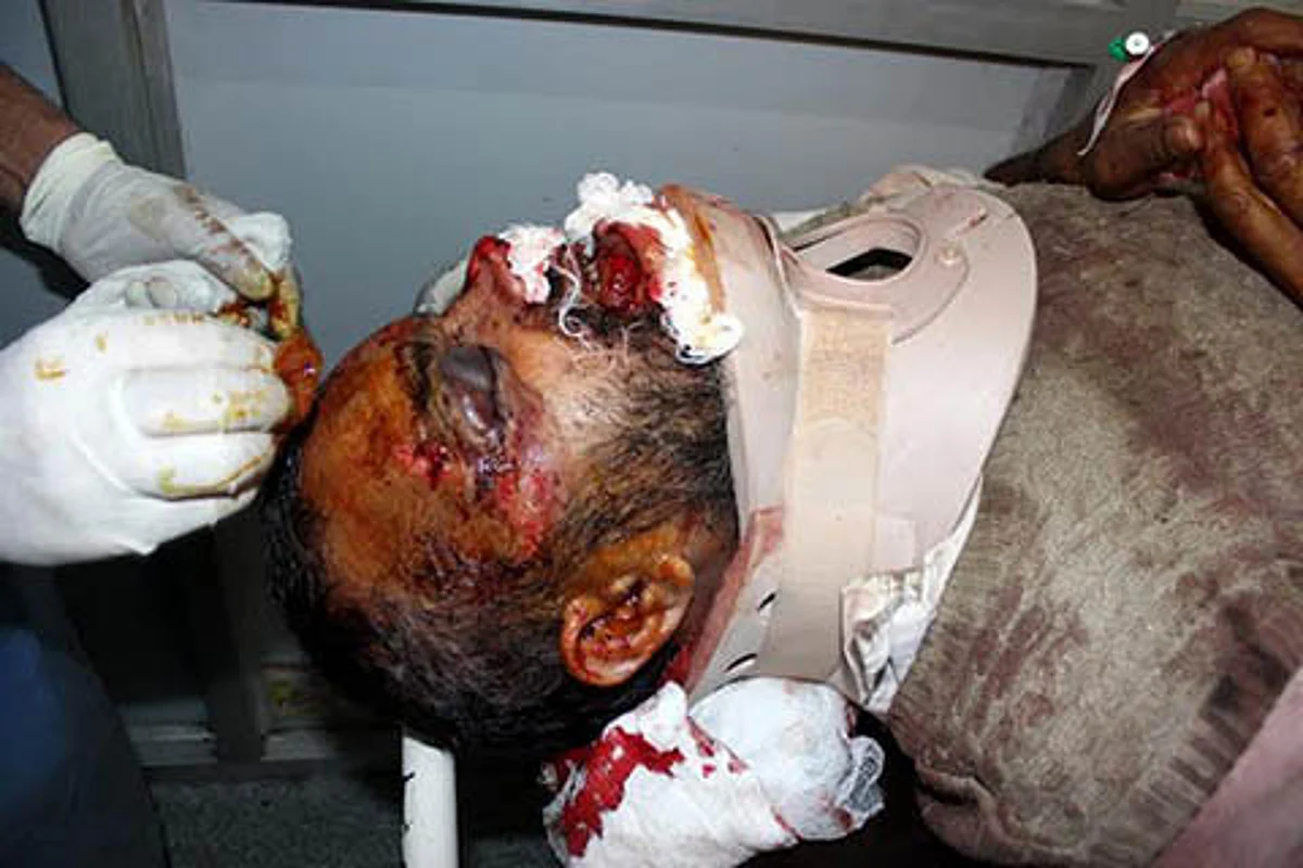 Youth killed in Qazigund, toll 73; 200 injured; protests continue