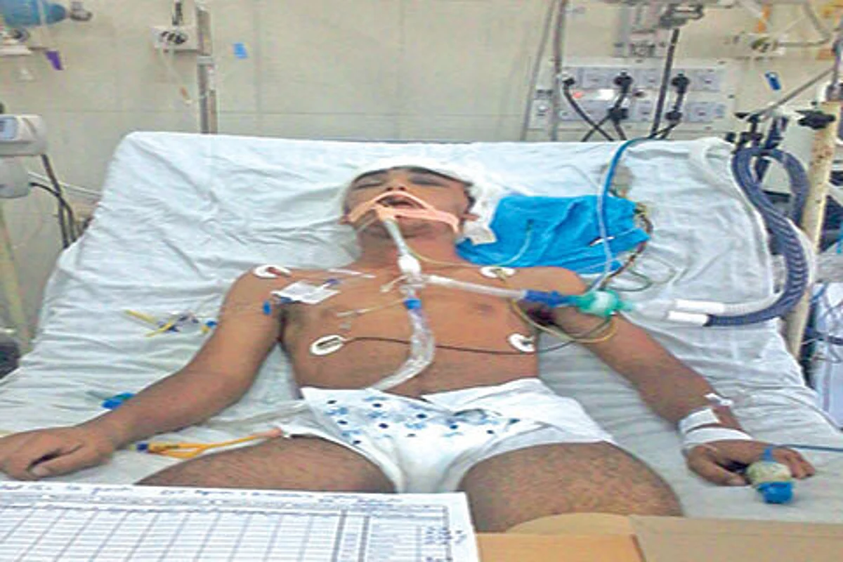 Hit by teargas shell, 14-year-old battles for life