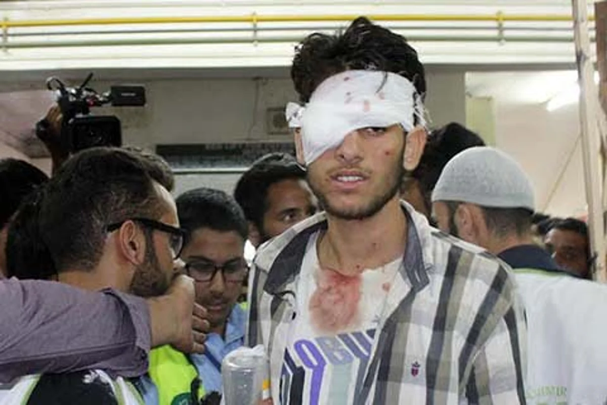 Doctors Fear 300 Pellet Victims will never be able to see again