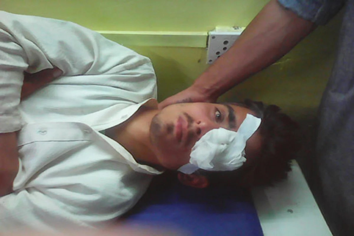 As pellet guns continue to be used on protesters in Kashmir, Govt bans their use on animals