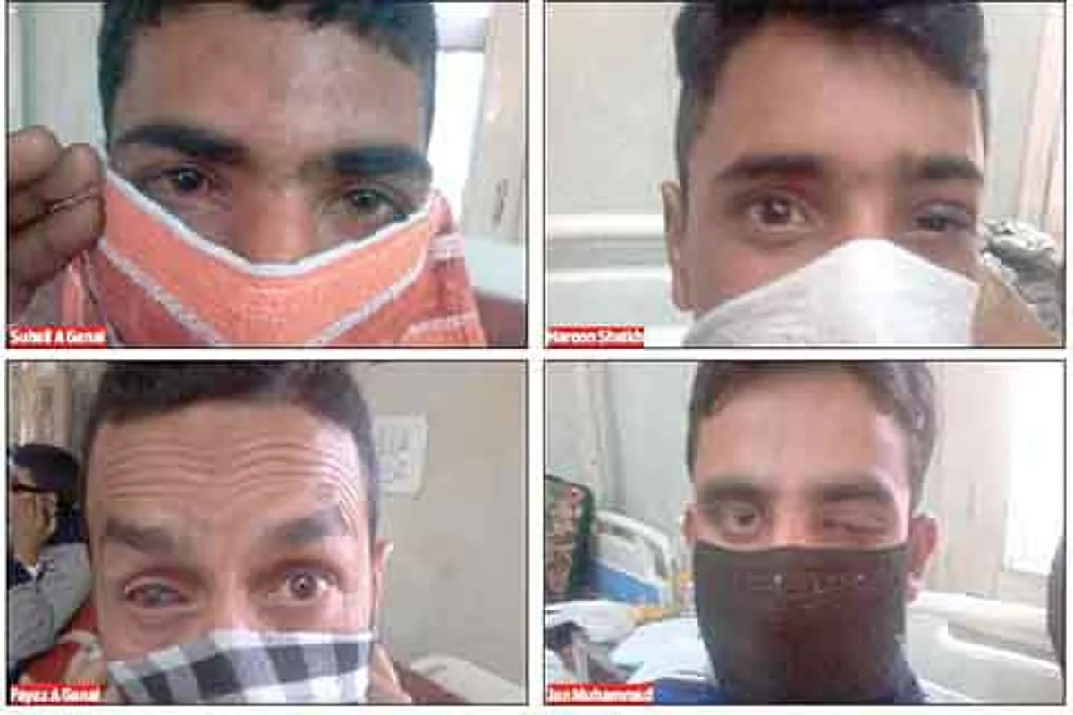 Hurriyat (G) concerned over plight of pellet victims