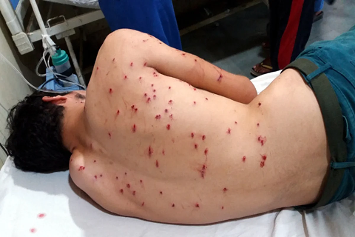 SC seeks response of Centre over ban on use of pellet guns in Kashmir
