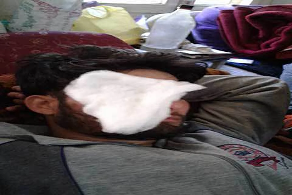 POLL DAY HORROR: 12-yr old battles bullet, pellet injuries; 35-yr old critical; 21 pellet victims may lose eyesight
