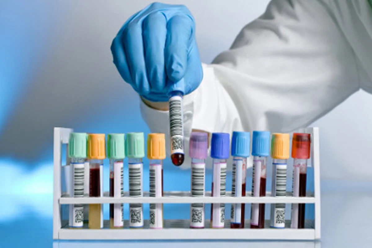 LABORATORY ERRORS - THINK BEFORE YOU SIGN