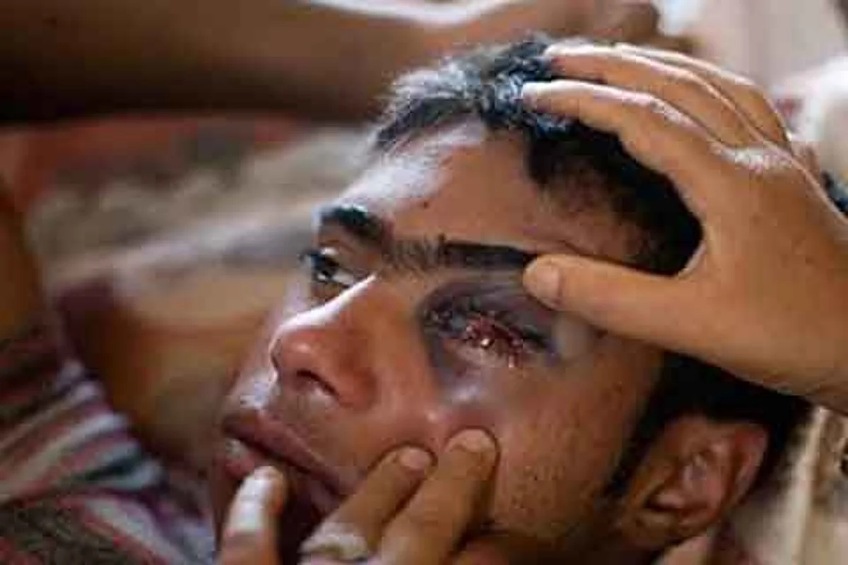 1314 eyes of 1253 victims impaired since 2016 alone