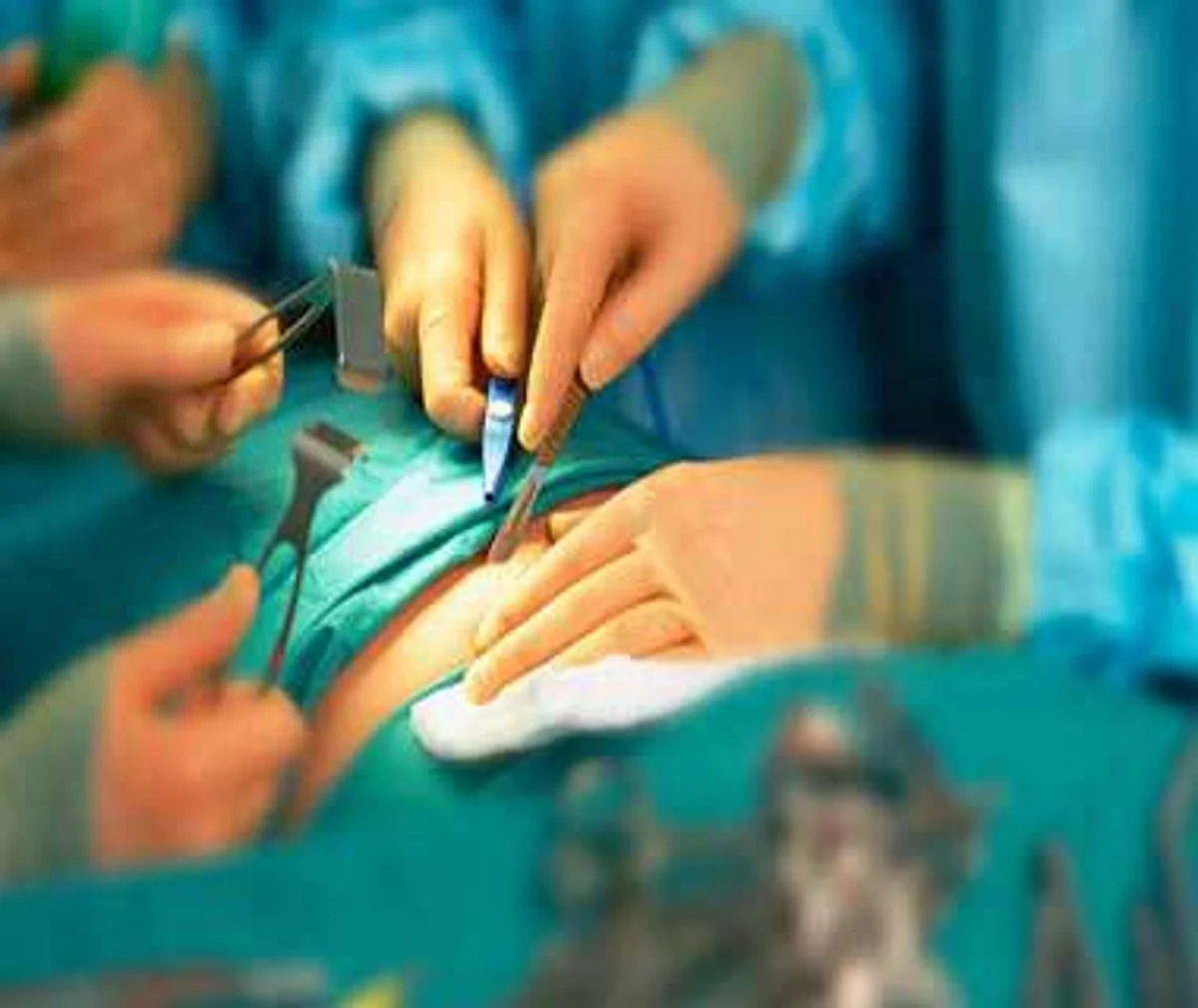 DH Ramban starts laparoscopic surgery