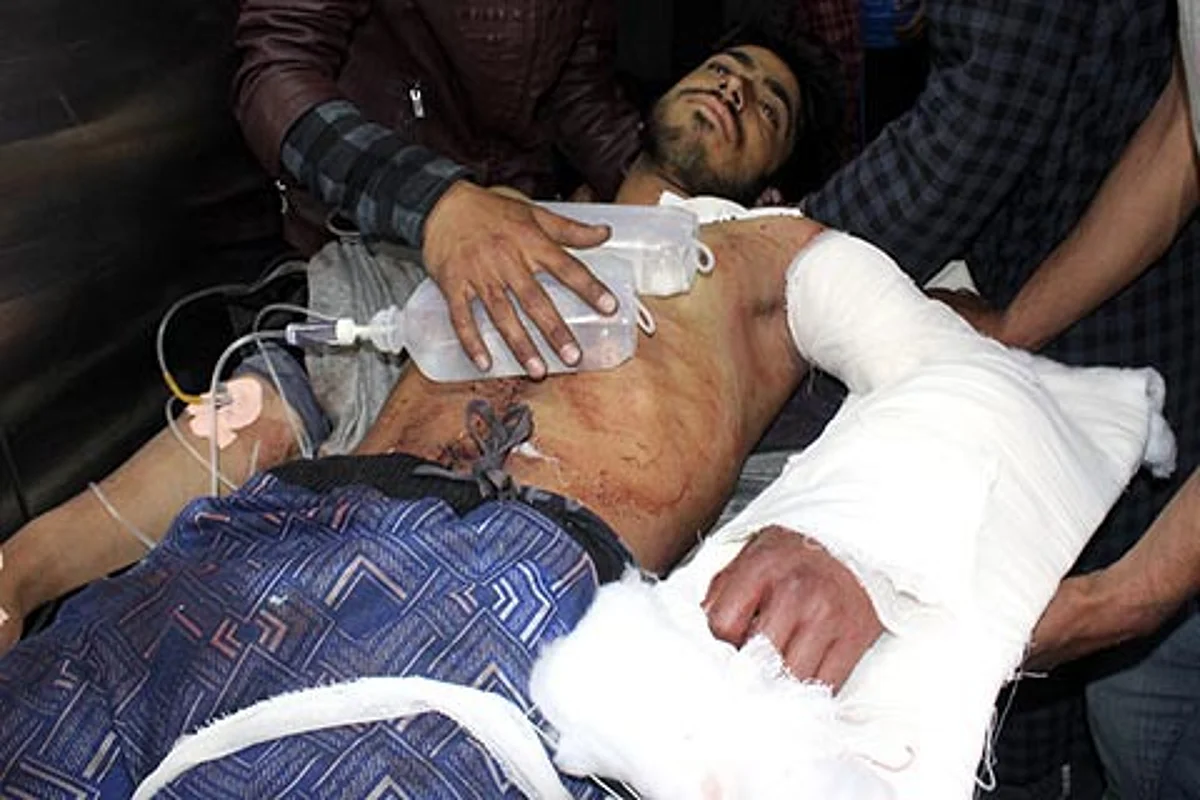 Srinagar hospitals receive 45 youth with bullet, pellet injuries; 3 critical, say doctors