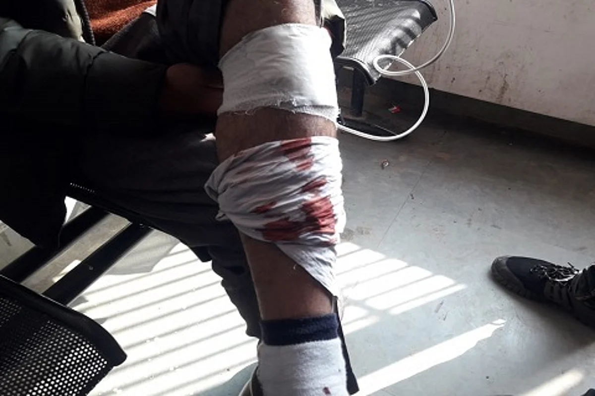 Pack of stray dogs attacks and injures 51 persons in north Kashmir’s Baramulla