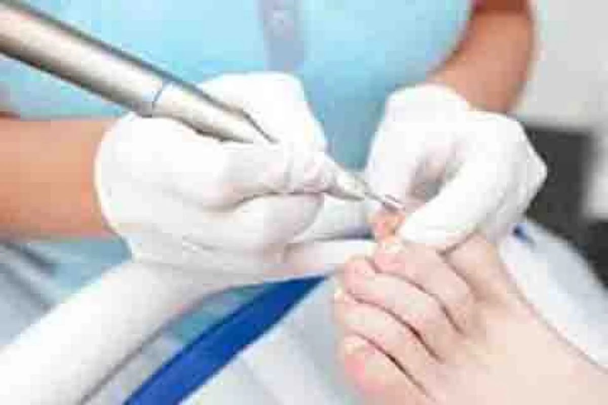 Diabetic Foot – A serious threat