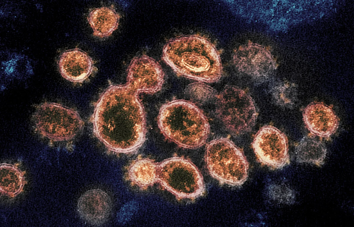Three more persons test positive for coronavirus in Ladakh; total cases 13