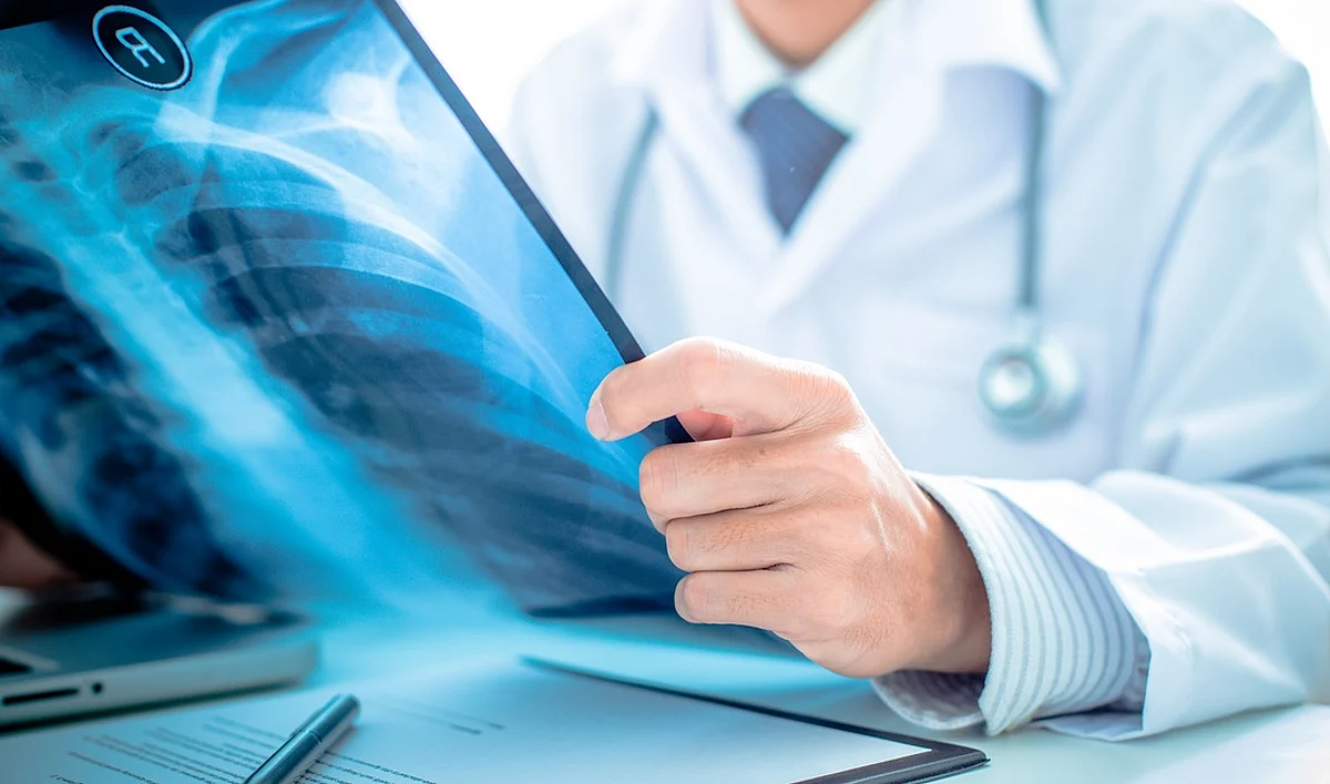 SDH Mandi without radiologist, patients suffer