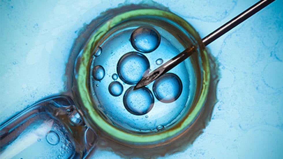 Doctors' Group Expands Definition of 'Infertility' - Vimarsana News