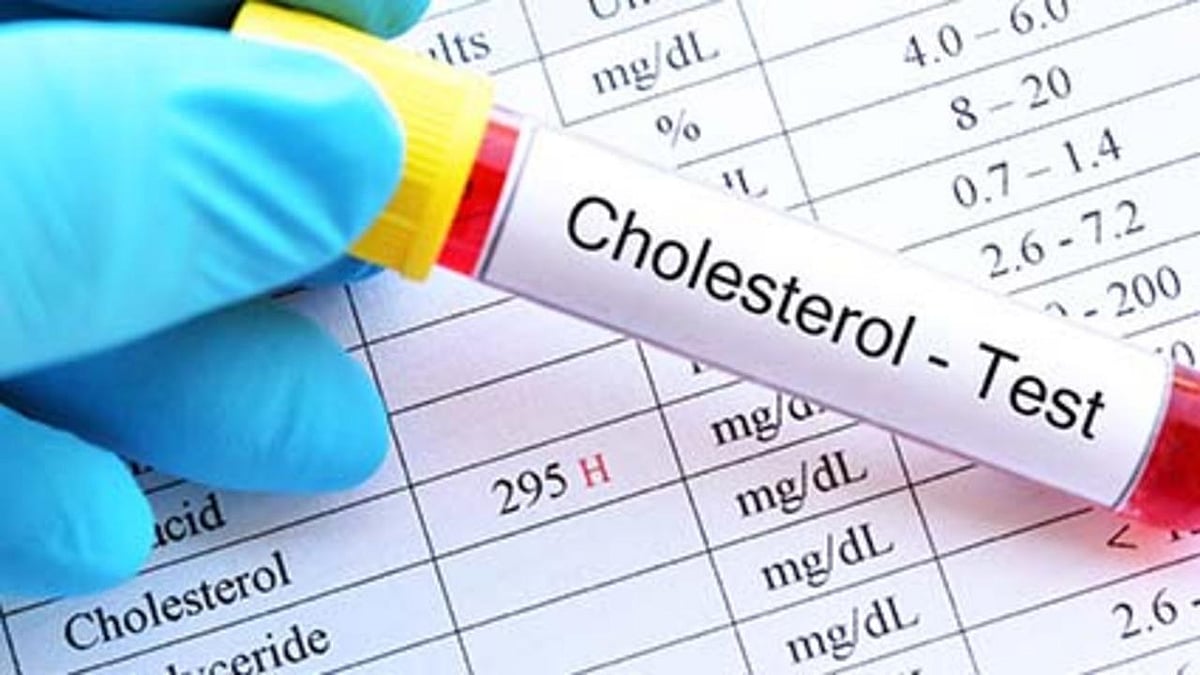 While Fewer Americans Have High Cholesterol, Too Many Still Do - Vimarsana News