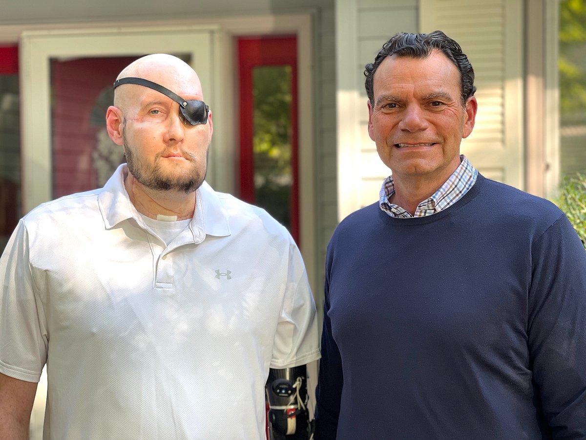 Man Maimed by Electric Shock Receives First-Ever Face Transplant That Includes New Eye - Vimarsana News