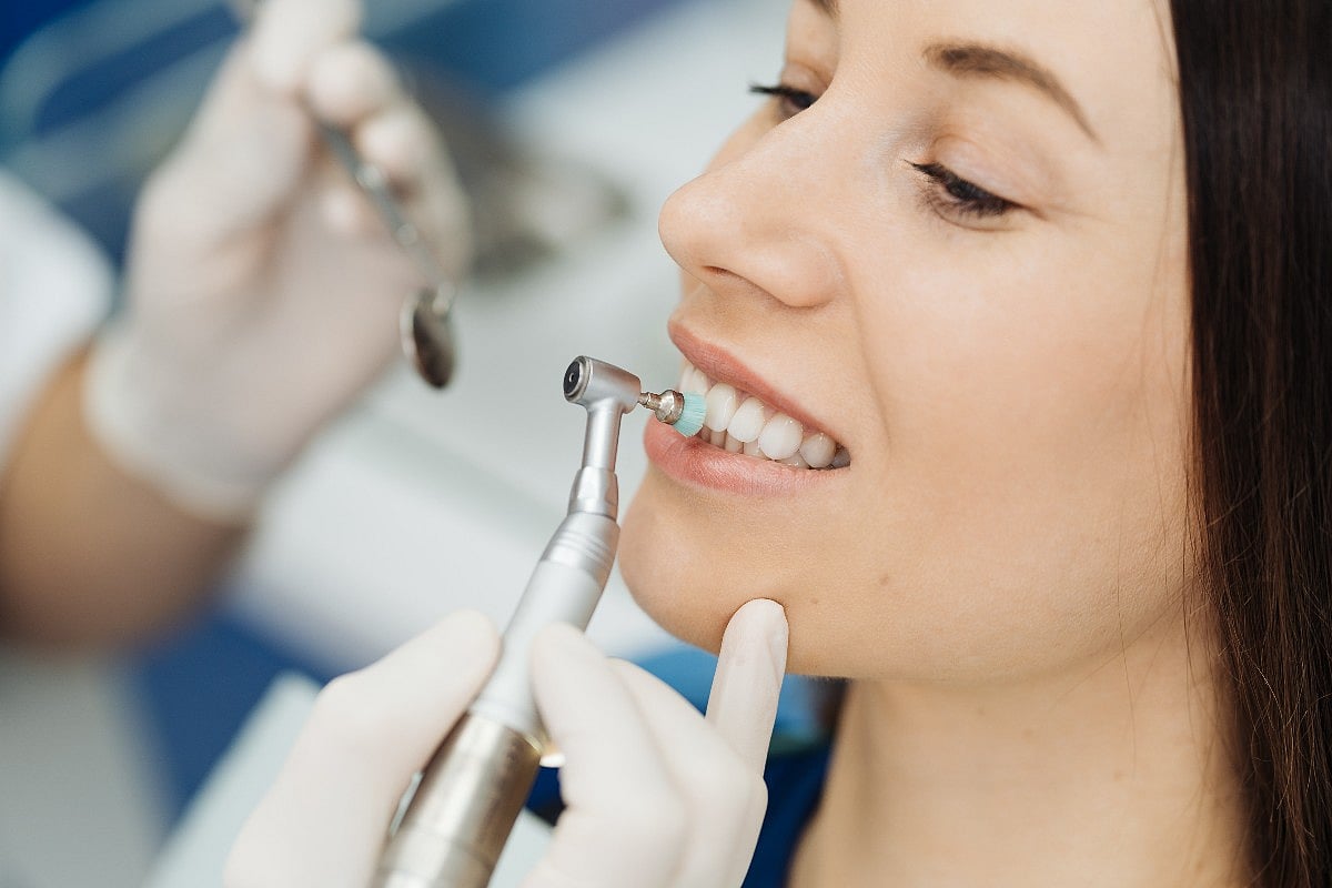 Dental Veneers: Everything You Need to Know