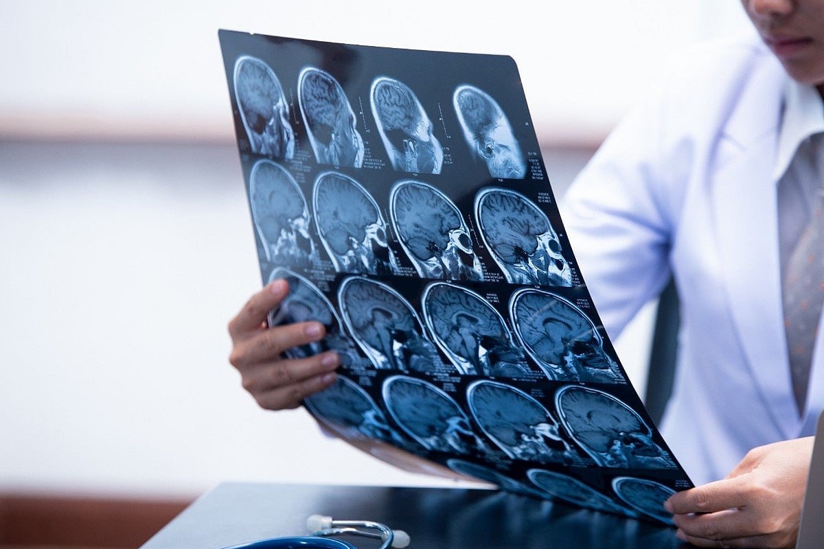 Brain Implant Lets Woman Talk After 18 Years of Silence Due to Stroke