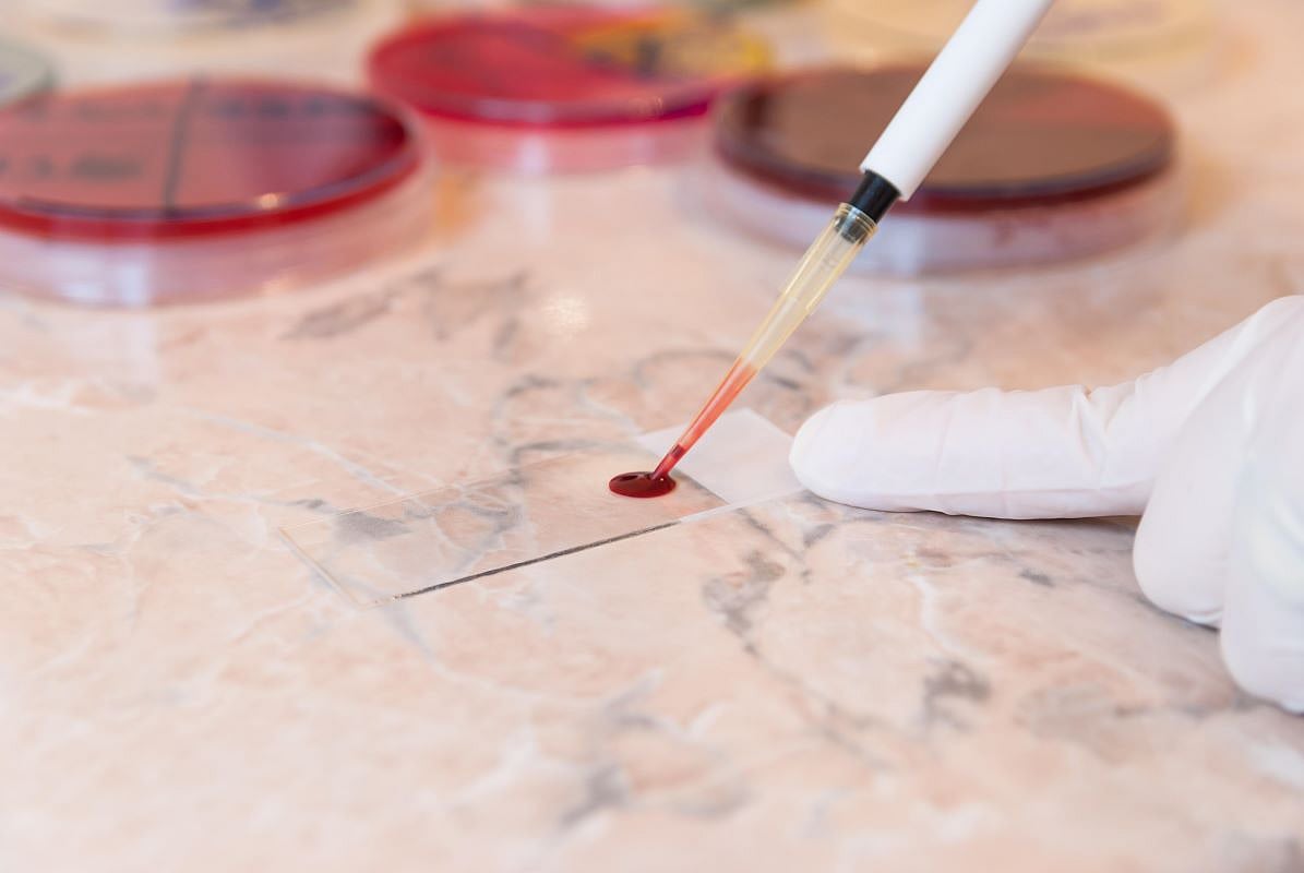 New Blood Test Could Predict Women's 30-year Risk for Heart Disease