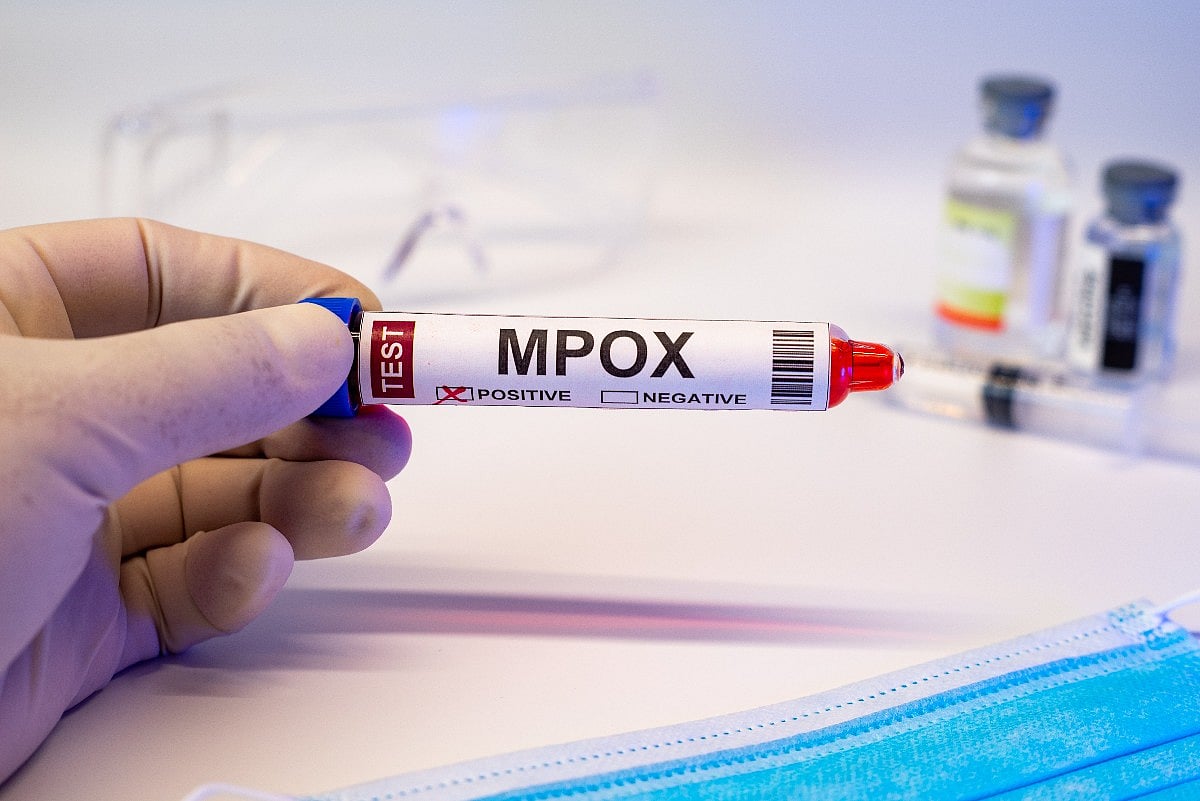 New Strain of Mpox Spreading in Africa Has CDC Concerned