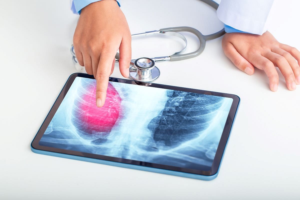 Kansas Reports Largest Tuberculosis Outbreak in U.S. History