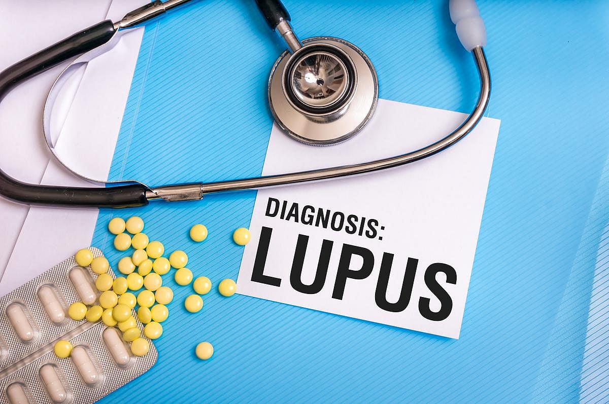 Could CAR-T Therapy Be a Cure for Lupus? Early Trials Show Promise