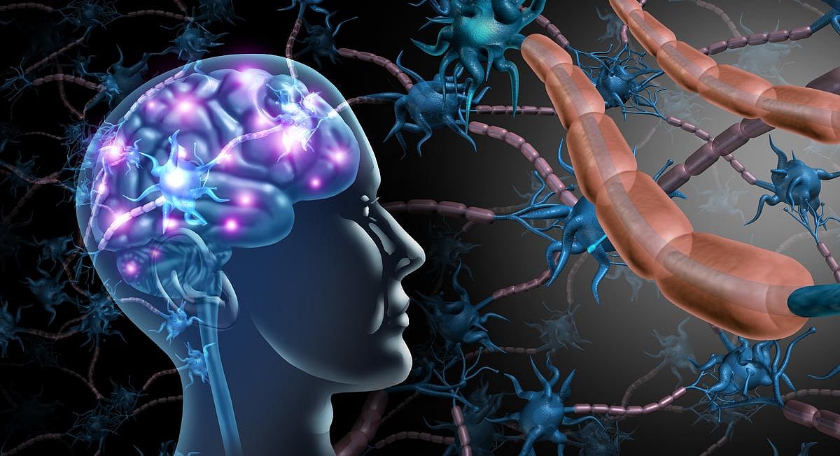 Stroke, Dementia, Depression Share Many Risk Factors