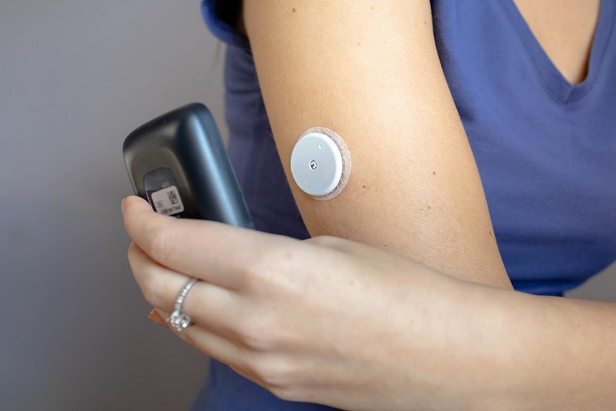 Continuous Glucose Monitors Can Overestimate Blood Sugar Levels, Study Finds