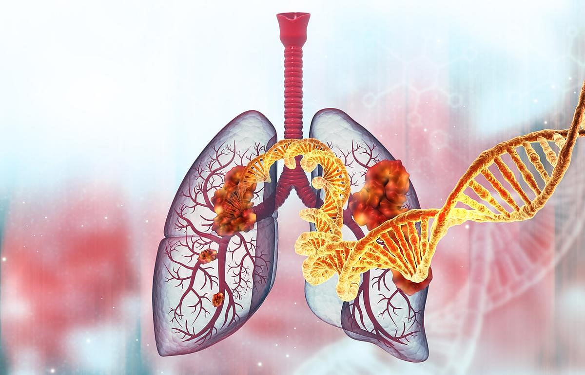 Clash Of Drugs Impedes Lung Cancer Treatment, Lowers Survival