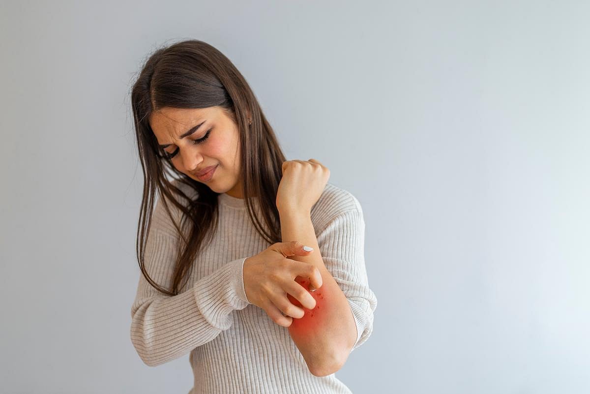 Ditch That Itch: Early Findings Offer Hope for Skin Issues Like Rosacea