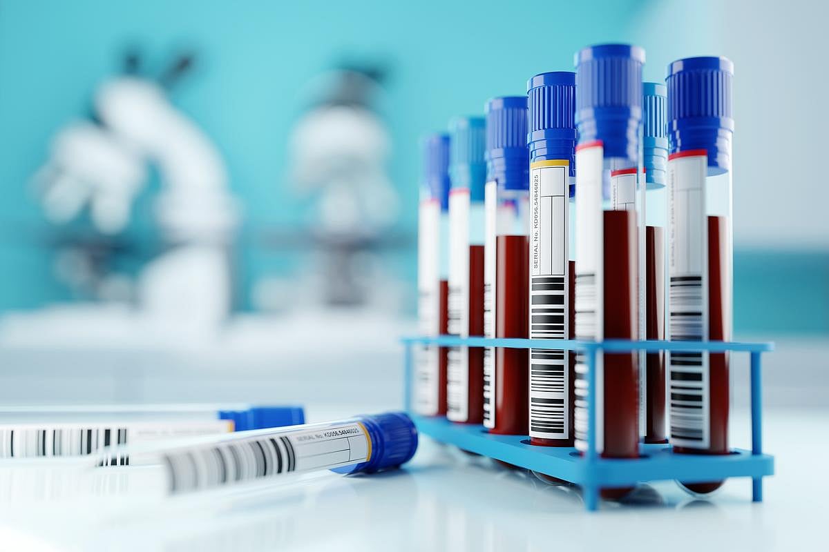 New Combo Drug Therapy Halves Death Risk From Advanced Hodgkin Lymphoma