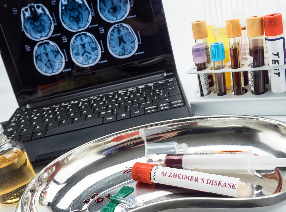 Most Americans Want Easy Early Testing For Alzheimer's