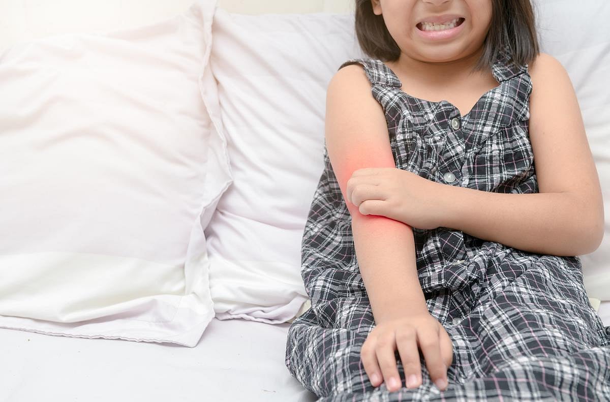 Are 'Elimination Diets' Much Help Against Child Eczema?