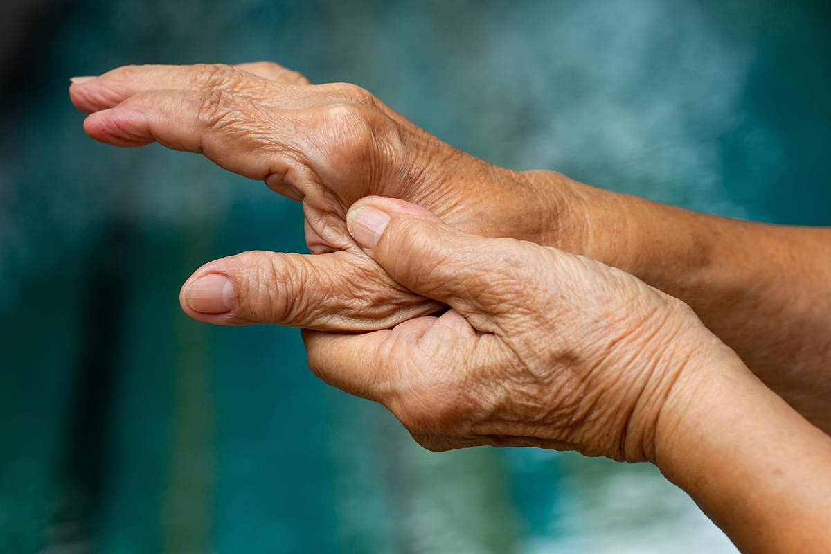 Psoriatic Arthritis Diagnoses Are Lagging, Patients Undertreated