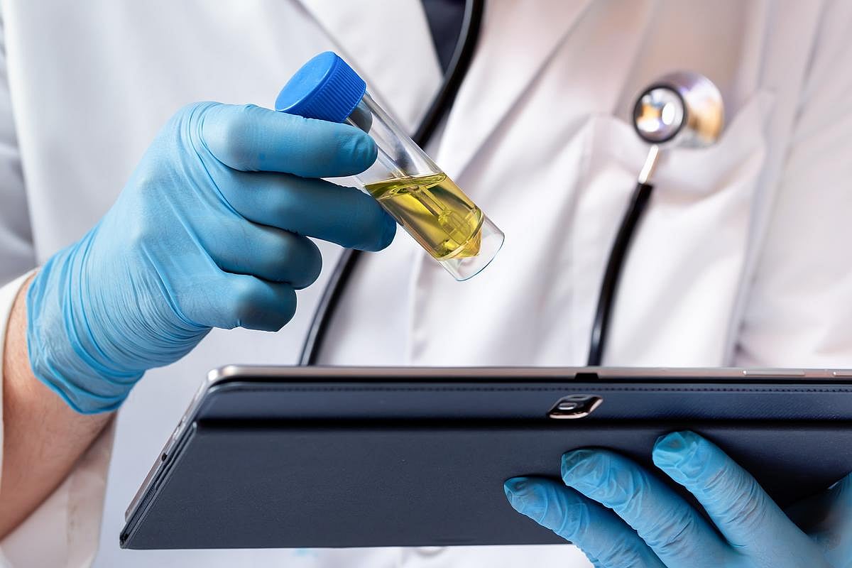 At-Home Urine Test Can Detect Aggressive Prostate Cancer