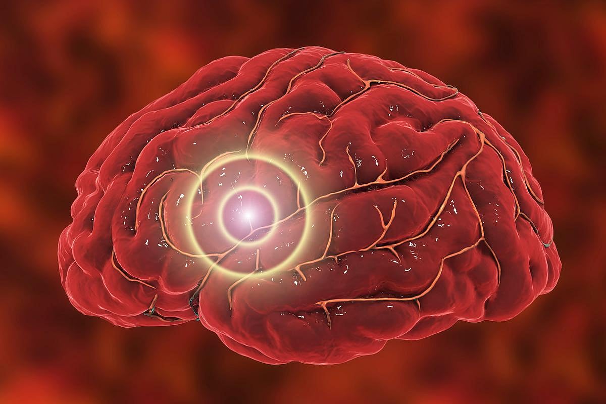 At-Home Brain Stimulation Treatment Can Safely Ease Depression