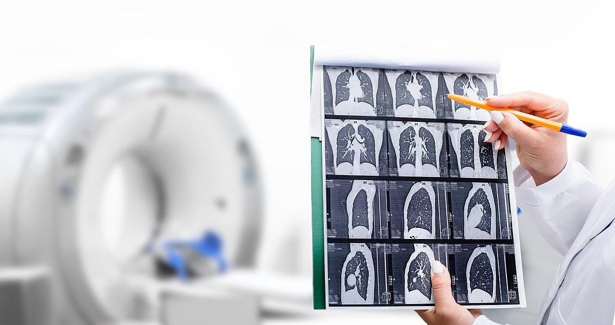 Lung Cancer Remains At Bay Long After Immune Therapy Is Dropped